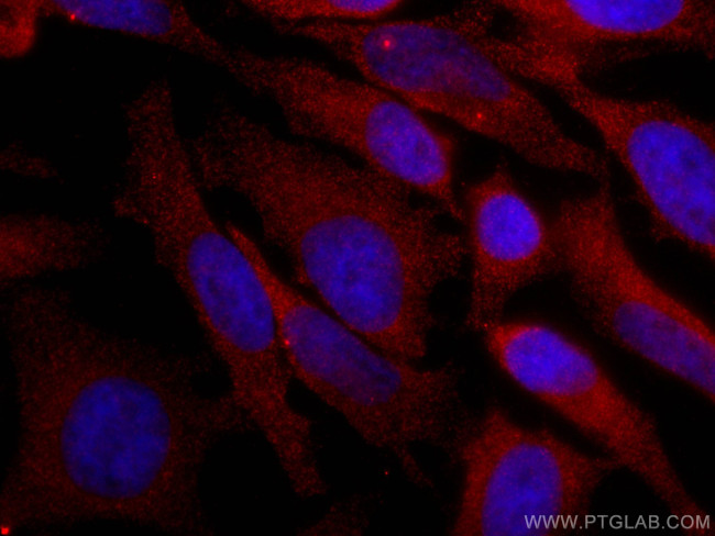 TRIM25 Antibody in Immunocytochemistry (ICC/IF)