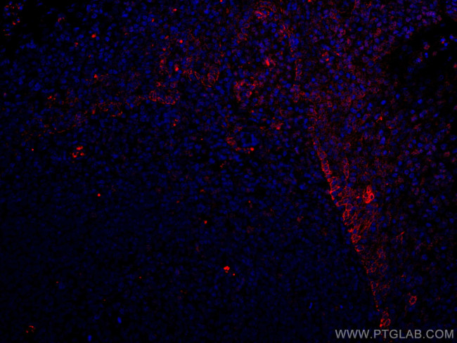 TLR8 Antibody in Immunohistochemistry (Paraffin) (IHC (P))