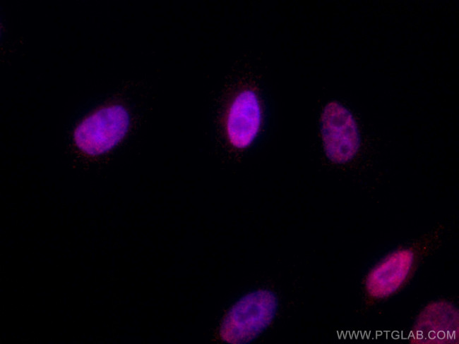 RCC1 Antibody in Immunocytochemistry (ICC/IF)