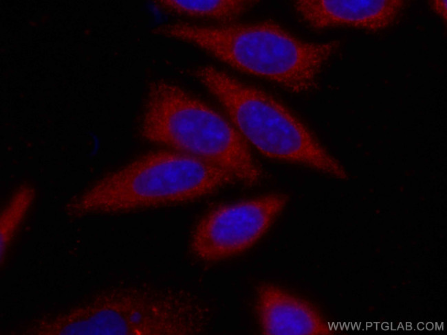 ATG7 Antibody in Immunocytochemistry (ICC/IF)