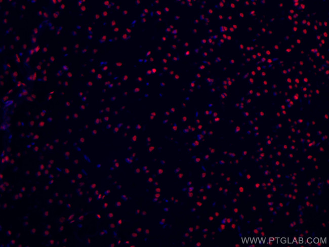 TDP-43 Antibody in Immunohistochemistry (Paraffin) (IHC (P))