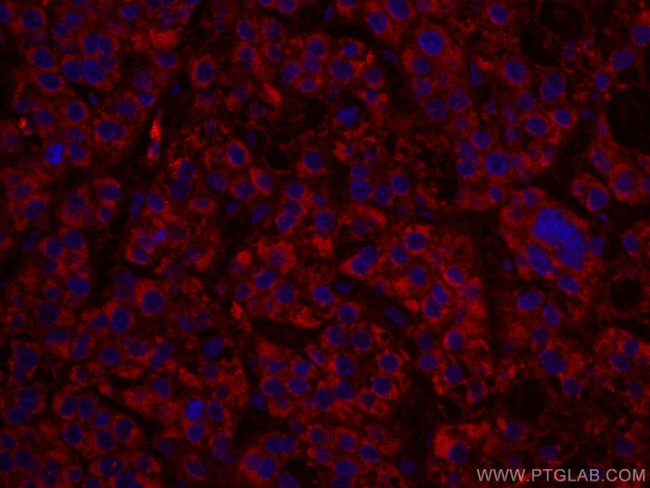 ALDH5A1 Antibody in Immunohistochemistry (Paraffin) (IHC (P))