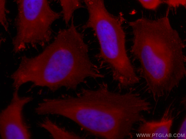 Profilin 1 Antibody in Immunocytochemistry (ICC/IF)