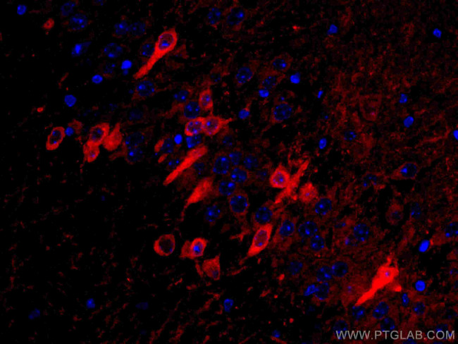 ACVR1 Antibody in Immunohistochemistry (Paraffin) (IHC (P))