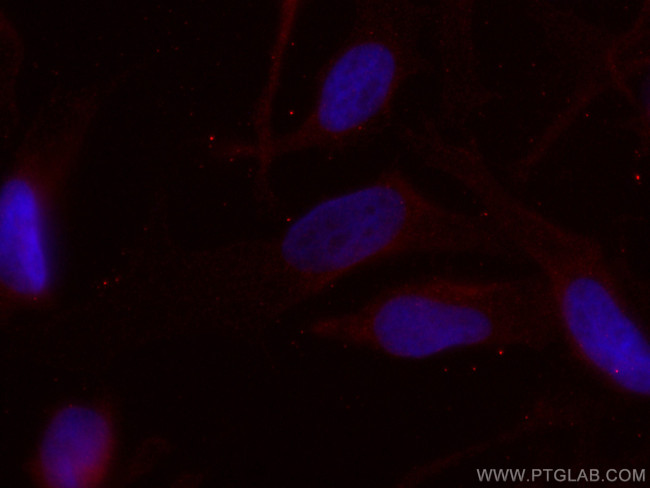 CDCA5 Antibody in Immunocytochemistry (ICC/IF)