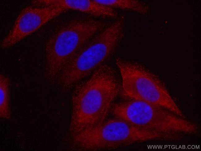 eIF4G2/DAP5 Antibody in Immunocytochemistry (ICC/IF)