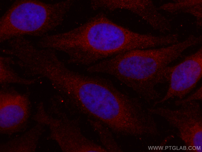 HRD1/SYVN1 Antibody in Immunocytochemistry (ICC/IF)