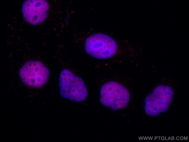 PDS5A Antibody in Immunocytochemistry (ICC/IF)