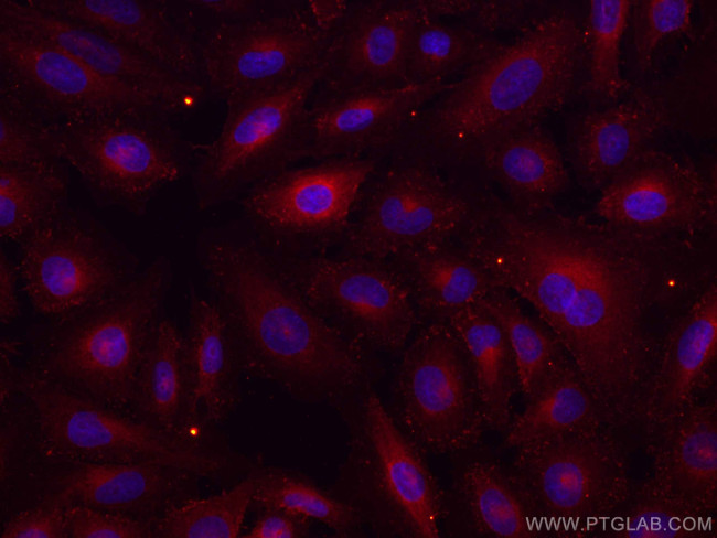 RHOC Antibody in Immunocytochemistry (ICC/IF)