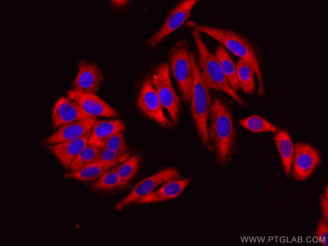 EEF2 Antibody in Immunocytochemistry (ICC/IF)