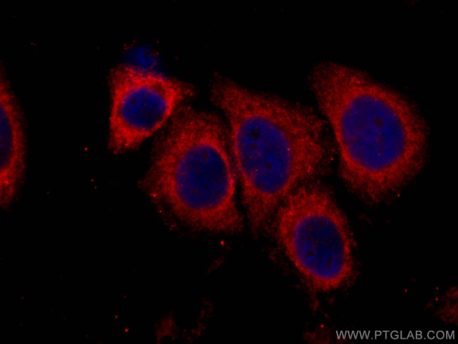 RIG-1/DDX58 Antibody in Immunocytochemistry (ICC/IF)