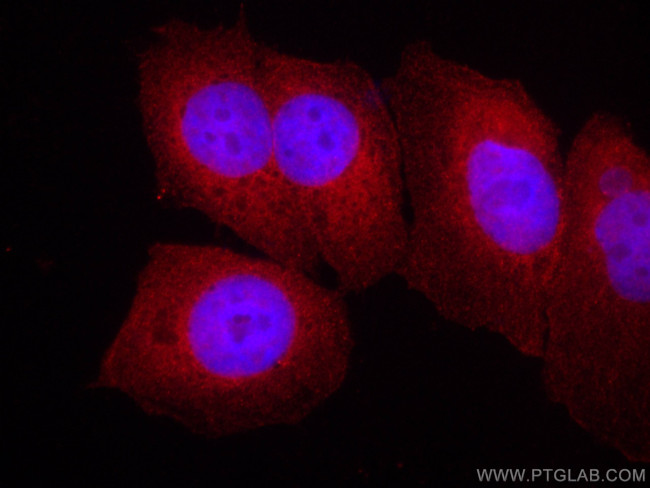 EIF1 Antibody in Immunocytochemistry (ICC/IF)