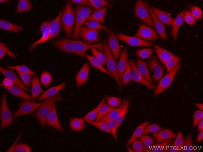 EIF1 Antibody in Immunocytochemistry (ICC/IF)