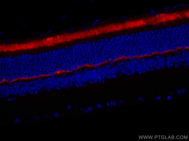 ANO2 Antibody in Immunohistochemistry (Paraffin) (IHC (P))