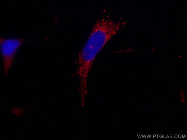 SNF8 Antibody in Immunocytochemistry (ICC/IF)