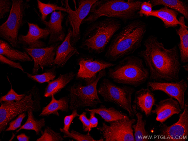 TXNRD1 Antibody in Immunocytochemistry (ICC/IF)