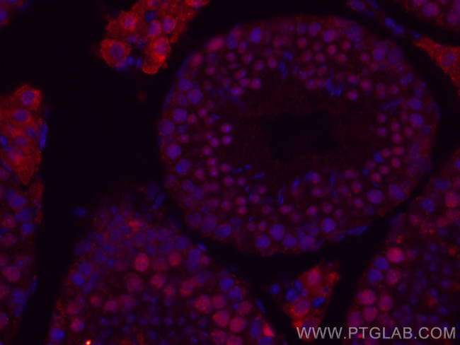 METTL3 Antibody in Immunohistochemistry (Paraffin) (IHC (P))