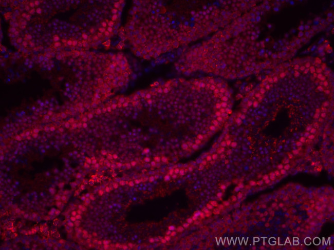 METTL3 Antibody in Immunohistochemistry (Paraffin) (IHC (P))