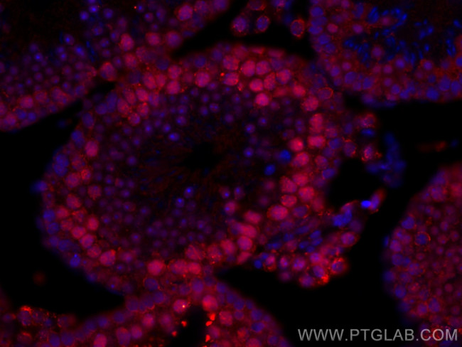 METTL3 Antibody in Immunohistochemistry (Paraffin) (IHC (P))