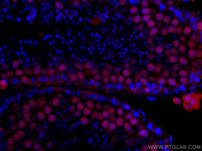 METTL3 Antibody in Immunohistochemistry (Paraffin) (IHC (P))