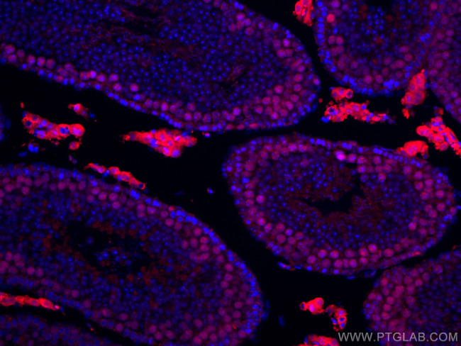 METTL3 Antibody in Immunohistochemistry (Paraffin) (IHC (P))