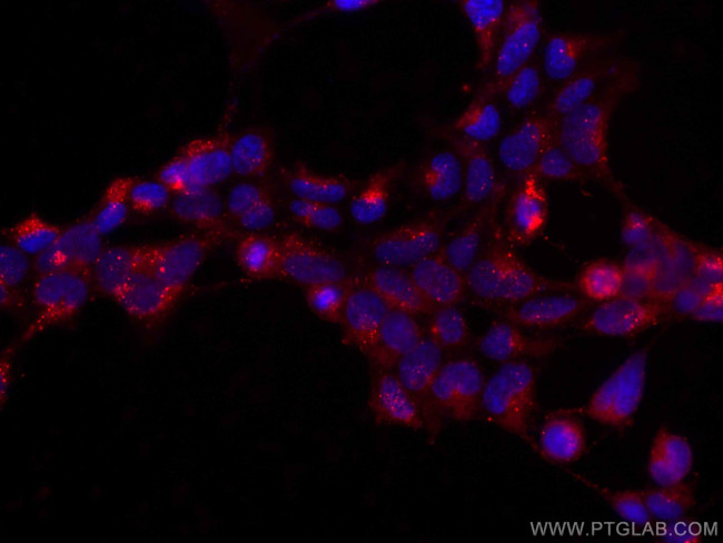 GPX4 Antibody in Immunocytochemistry (ICC/IF)