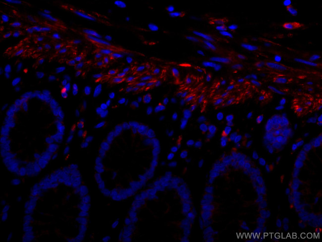 Desmin Antibody in Immunohistochemistry (Paraffin) (IHC (P))