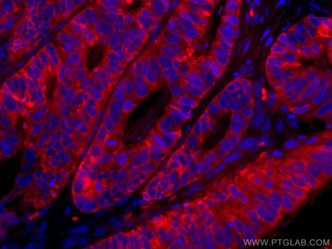 CNOT4 Antibody in Immunohistochemistry (Paraffin) (IHC (P))