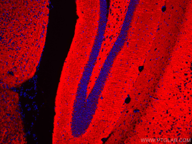 Synaptophysin Antibody in Immunohistochemistry (Paraffin) (IHC (P))