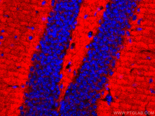 Synaptophysin Antibody in Immunohistochemistry (Paraffin) (IHC (P))