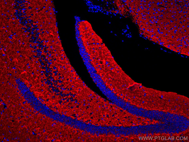 Synaptophysin Antibody in Immunohistochemistry (Paraffin) (IHC (P))