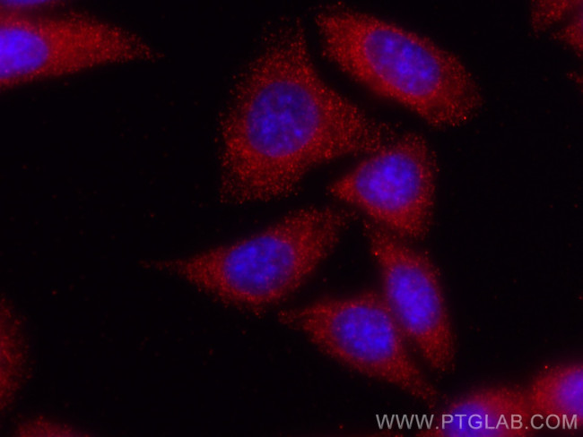 PGD Antibody in Immunocytochemistry (ICC/IF)