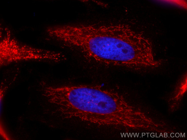 HADHB Antibody in Immunocytochemistry (ICC/IF)