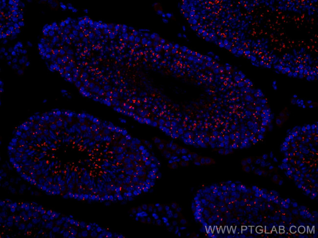 TEX14 Antibody in Immunohistochemistry (Paraffin) (IHC (P))