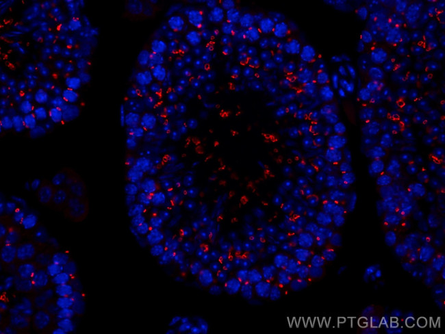 TEX14 Antibody in Immunohistochemistry (Paraffin) (IHC (P))