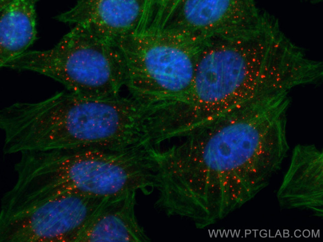 EEA1 Antibody in Immunocytochemistry (ICC/IF)