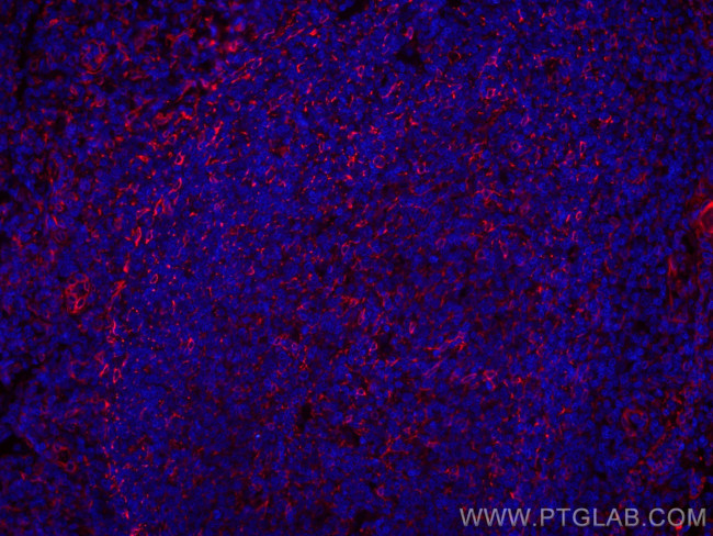 TMEM173/STING Antibody in Immunohistochemistry (Paraffin) (IHC (P))