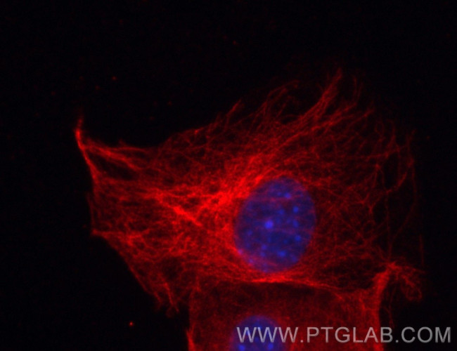 Beta Tubulin Antibody in Immunocytochemistry (ICC/IF)