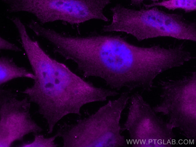 IRAK1 Antibody in Immunocytochemistry (ICC/IF)