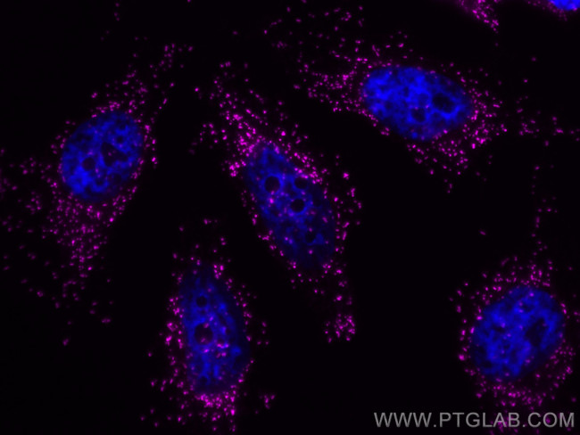 PEX14 Antibody in Immunocytochemistry (ICC/IF)