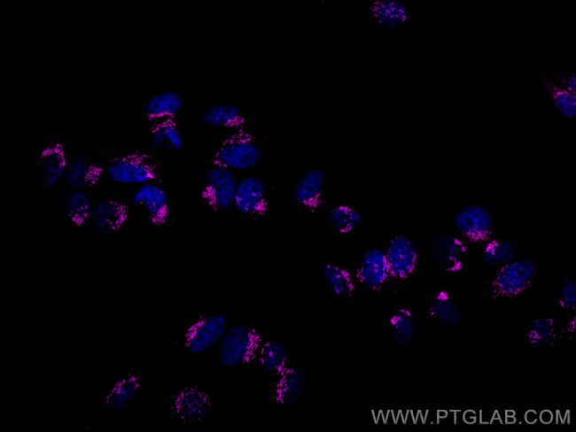 GOLGA2/GM130 Antibody in Immunocytochemistry (ICC/IF)