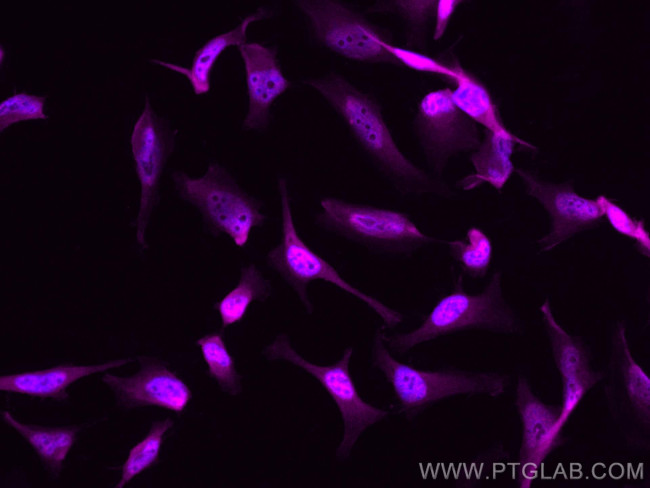 CDK9 Antibody in Immunocytochemistry (ICC/IF)