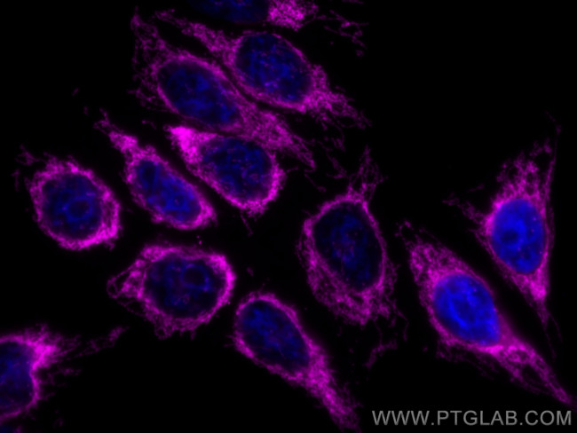 TOM20 Antibody in Immunocytochemistry (ICC/IF)