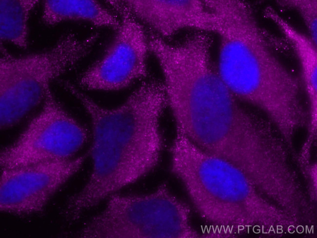 ACC1 Antibody in Immunocytochemistry (ICC/IF)