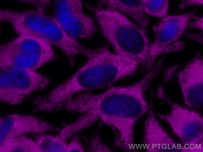 GAPDH Antibody in Immunocytochemistry (ICC/IF)