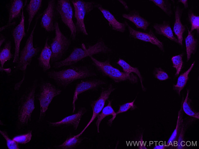 BAX Antibody in Immunocytochemistry (ICC/IF)