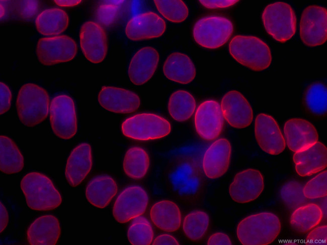 Lamin B1 Antibody in Immunocytochemistry (ICC/IF)