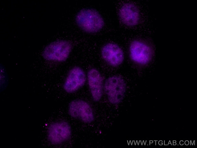 TBP Antibody in Immunocytochemistry (ICC/IF)