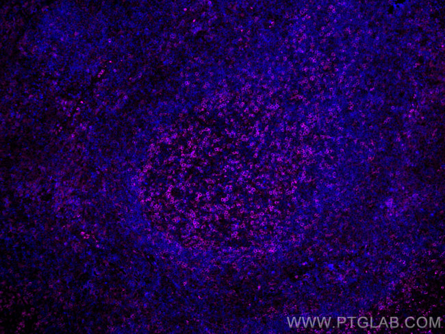 PD-1/CD279 Antibody in Immunohistochemistry (PFA fixed) (IHC (PFA))