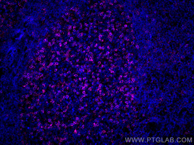 PD-1/CD279 Antibody in Immunohistochemistry (PFA fixed) (IHC (PFA))